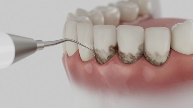 Reliable Dental Implants contractor in Keene, TX by Smile Center Dentistry